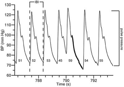 Modeling Arterial Pulse Pressure From Heart Rate During Sympathetic Activation by Progressive Central Hypovolemia